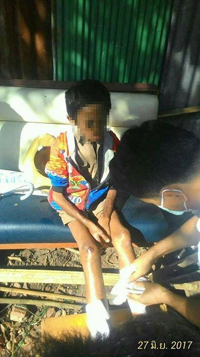 เด็กก้าวร้าว