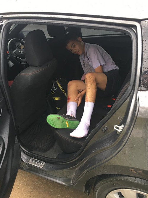 มอเตอร์ไซค์ชนท้าย