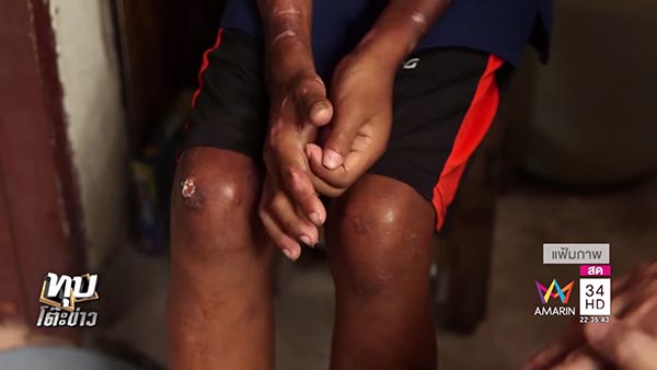 เด็ก 11 ขวบ