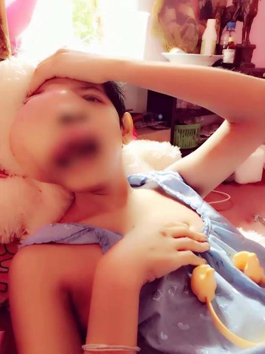 เจนี่ สาวป่วยมะเร็ง