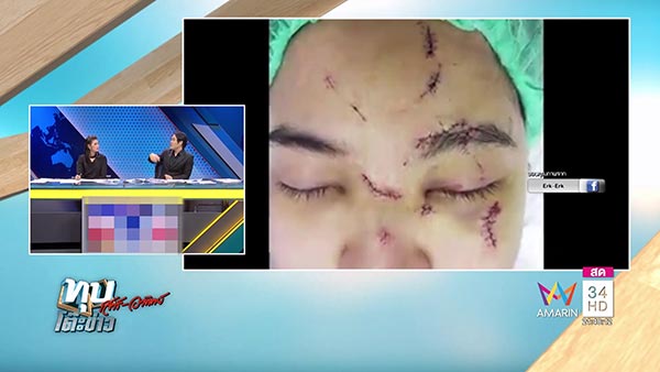 ดีเจอ้อนน้อย