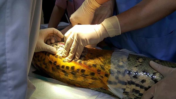 อนาคอนด้าผ่าตัดเนื้องอก