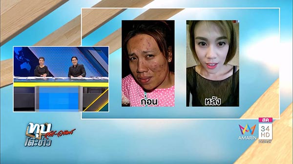 แอนตี้ วนารี