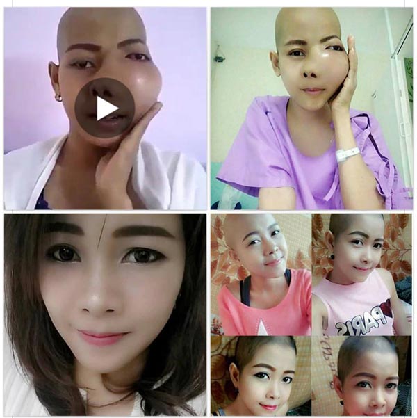 เจนี่ ป่วยมะเร็ง