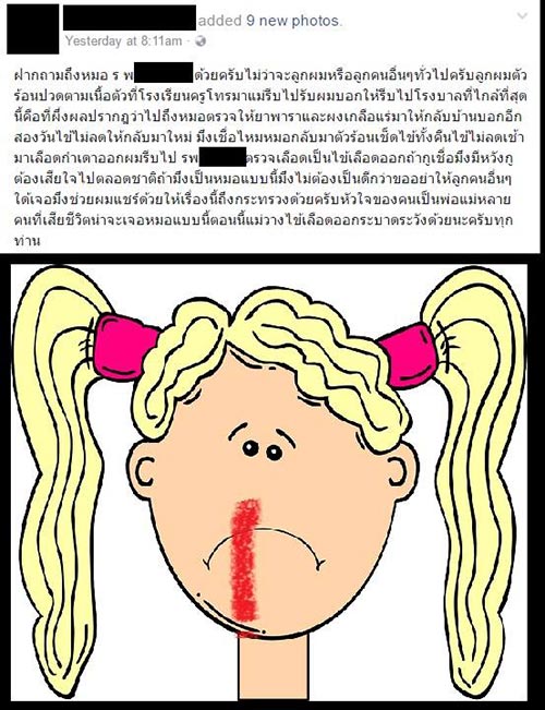 ไข้เลือดออก