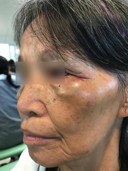 ลูกผู้มีอิทธิพลต่อยหน้า