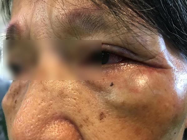 ลูกผู้มีอิทธิพลต่อยหน้า