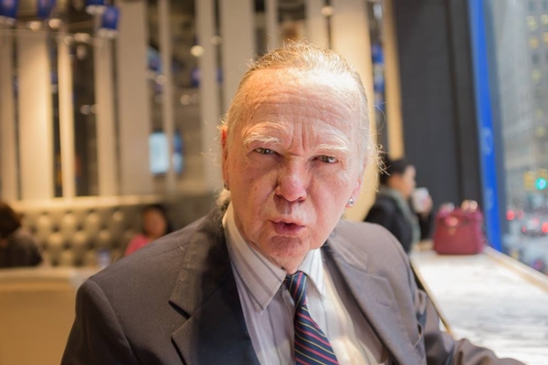 ลุงเนลสัน