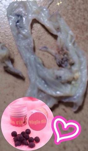 ยาสมุนไพรสอดจุดลับ