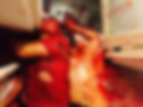 คดีแทงตายปริศนา