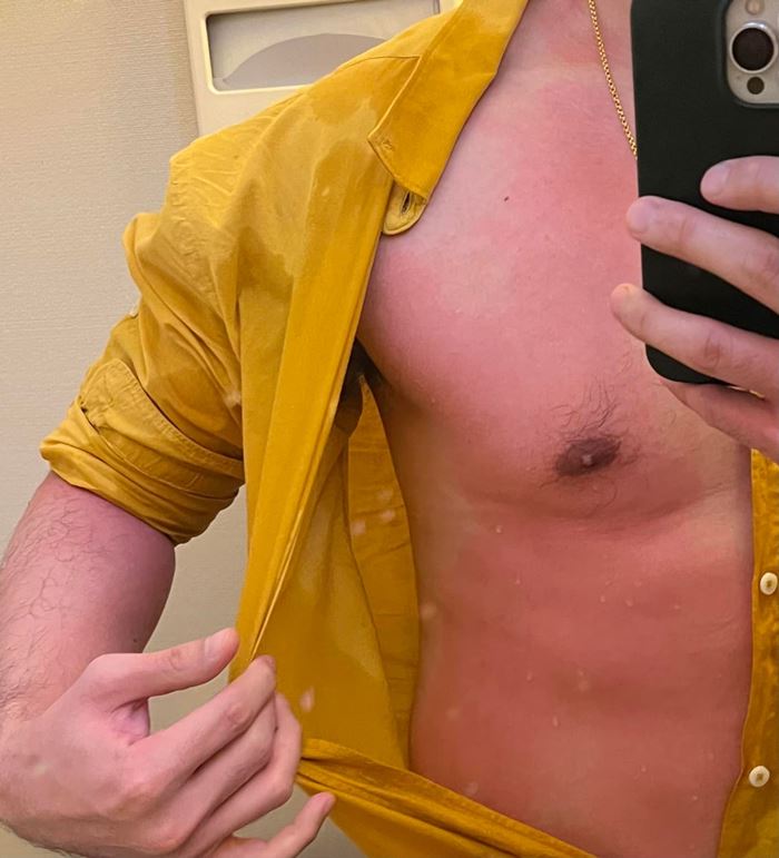 แอร์การบินไทย ทำกาแฟหกใส่ผู้โดยสาร