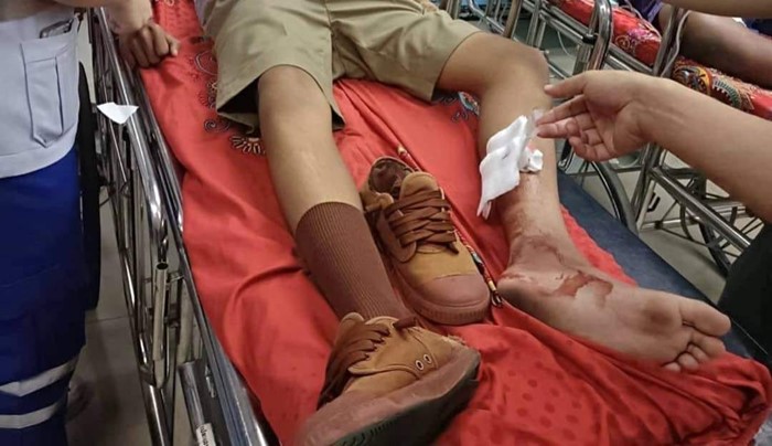 ปืนลั่นใส่อัณฑะ