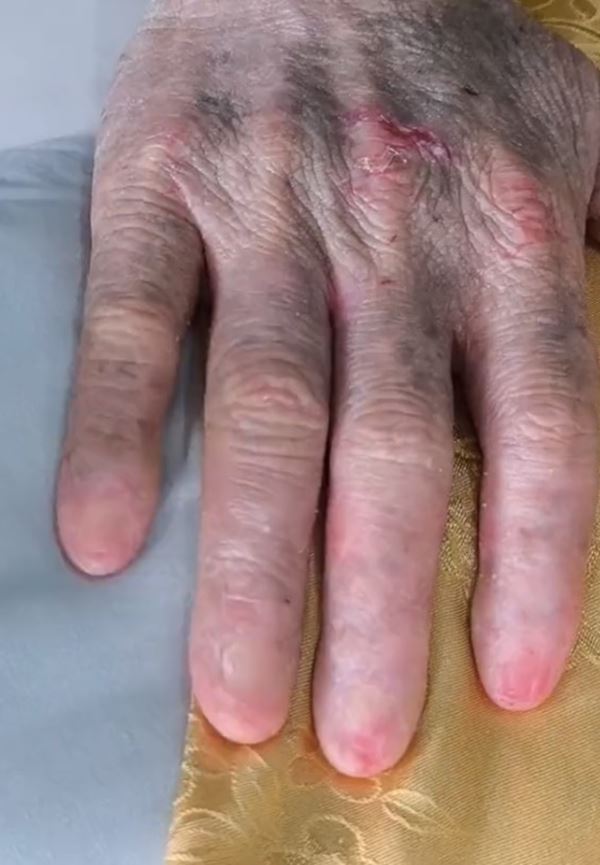 ฝ่ามือพลังจิต