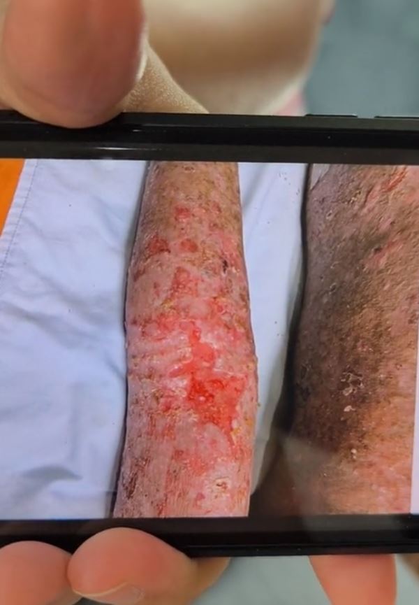 ฝ่ามือพลังจิต