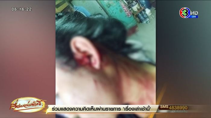 ทุบหัวชิงทรัพย์