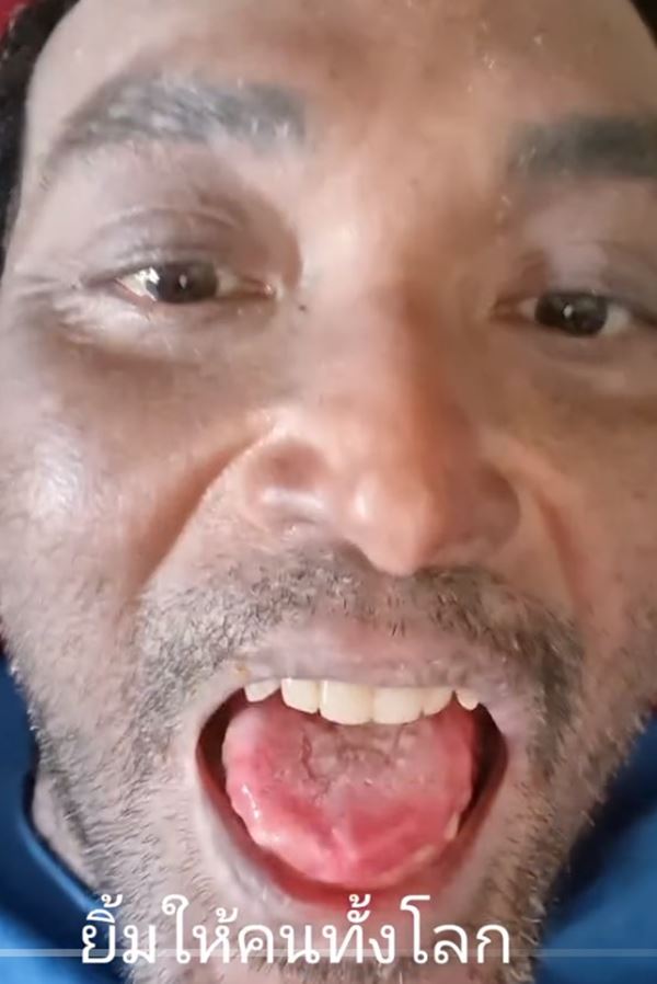 ฝ่ามือพลังจิต