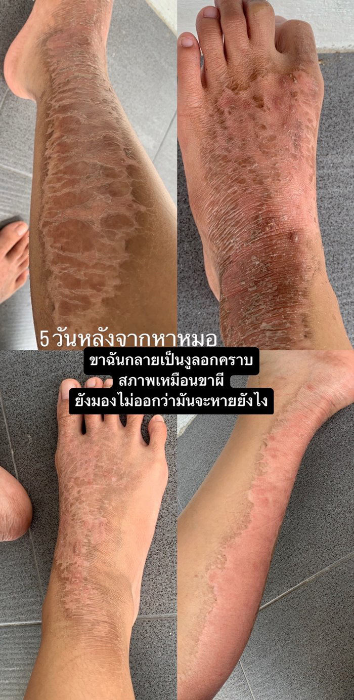 แมลงก้นกระดก