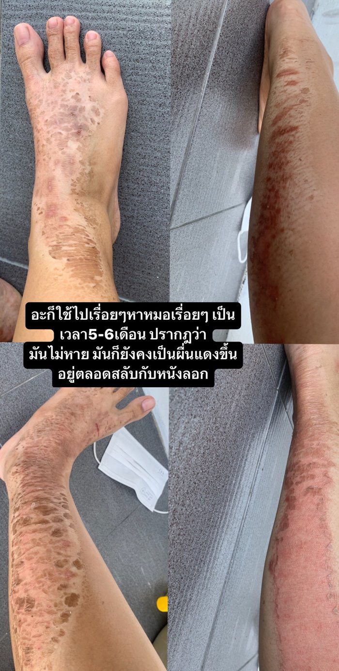 แมลงก้นกระดก
