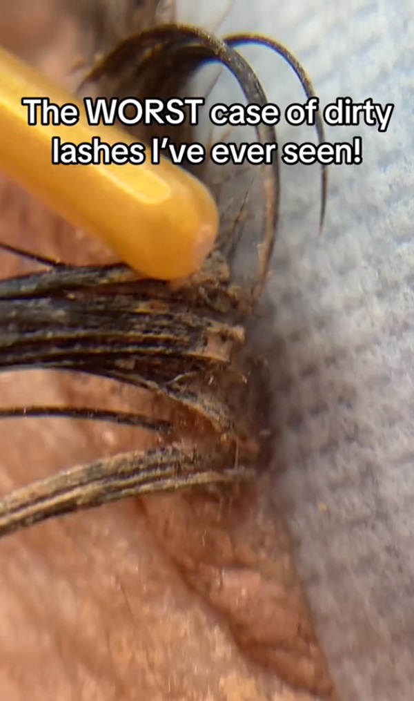 ขนตาสกปรก