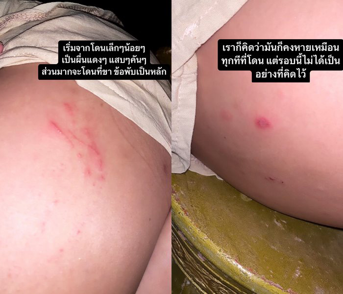 แมลงก้นกระดก