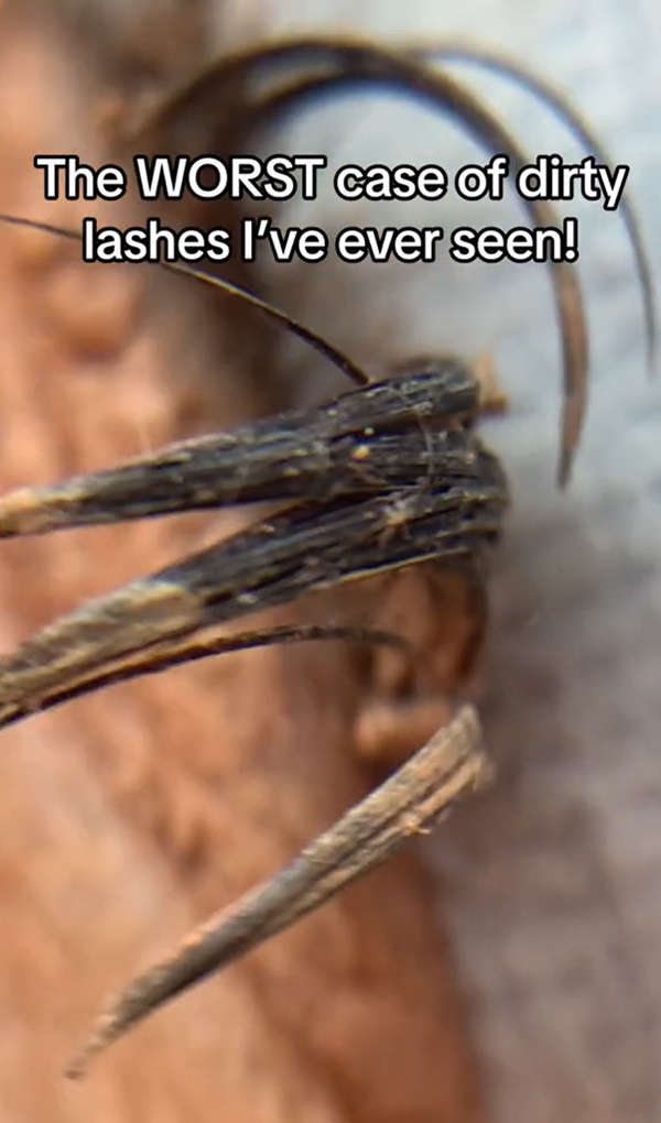 ขนตาสกปรก