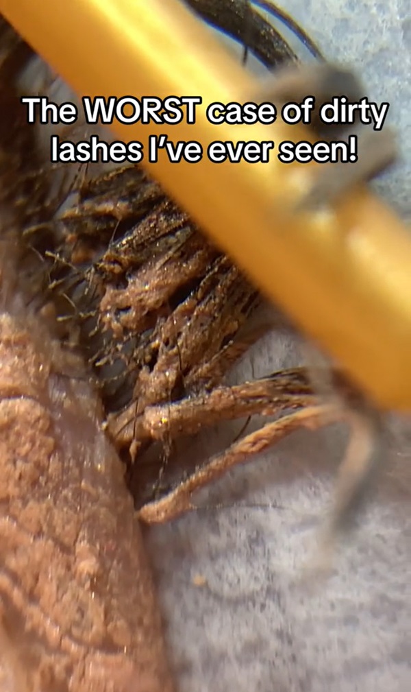 ขนตาสกปรก