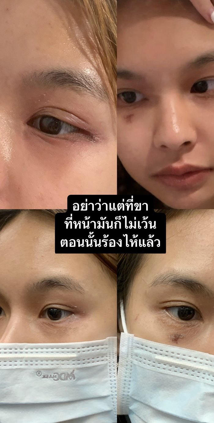 แมลงก้นกระดก