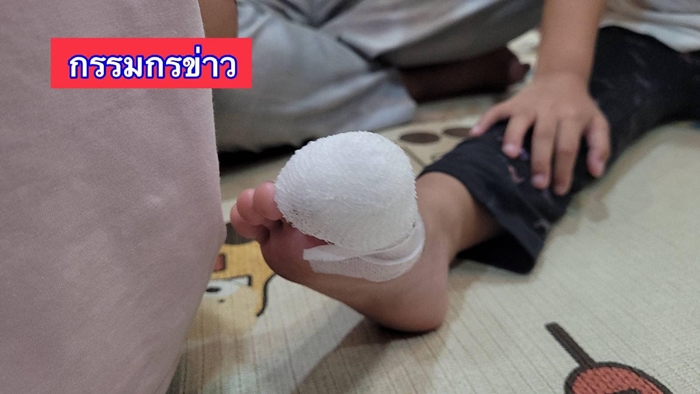 เท้าติดบันไดเลื่อน