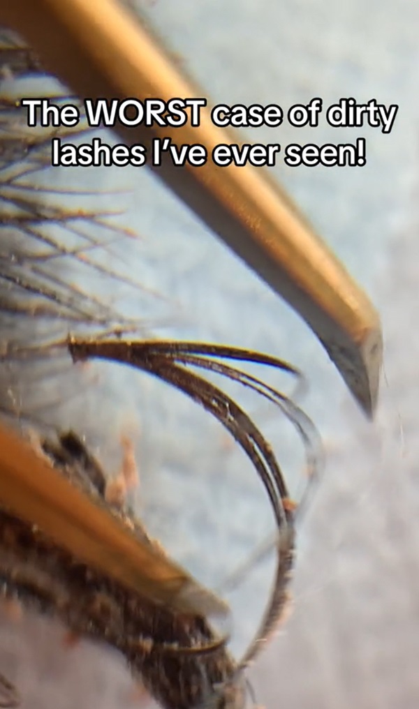 ขนตาสกปรก