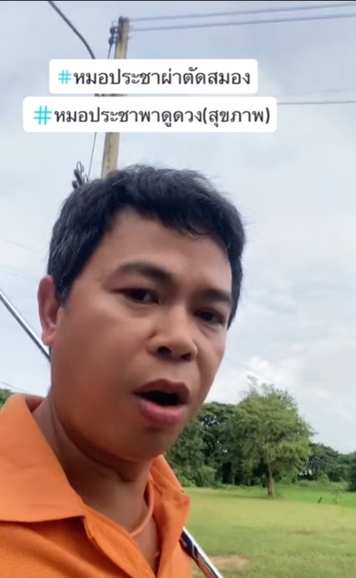 ผ่าตัดสมอง