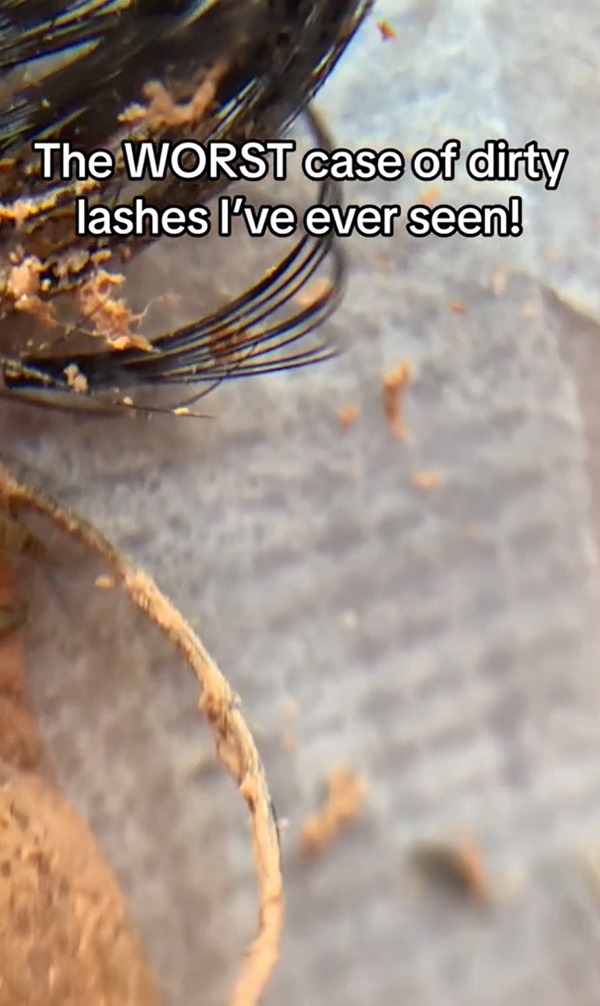 ขนตาสกปรก