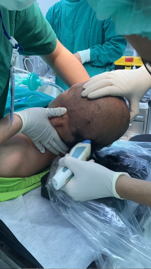 ผ่าตัดสมอง