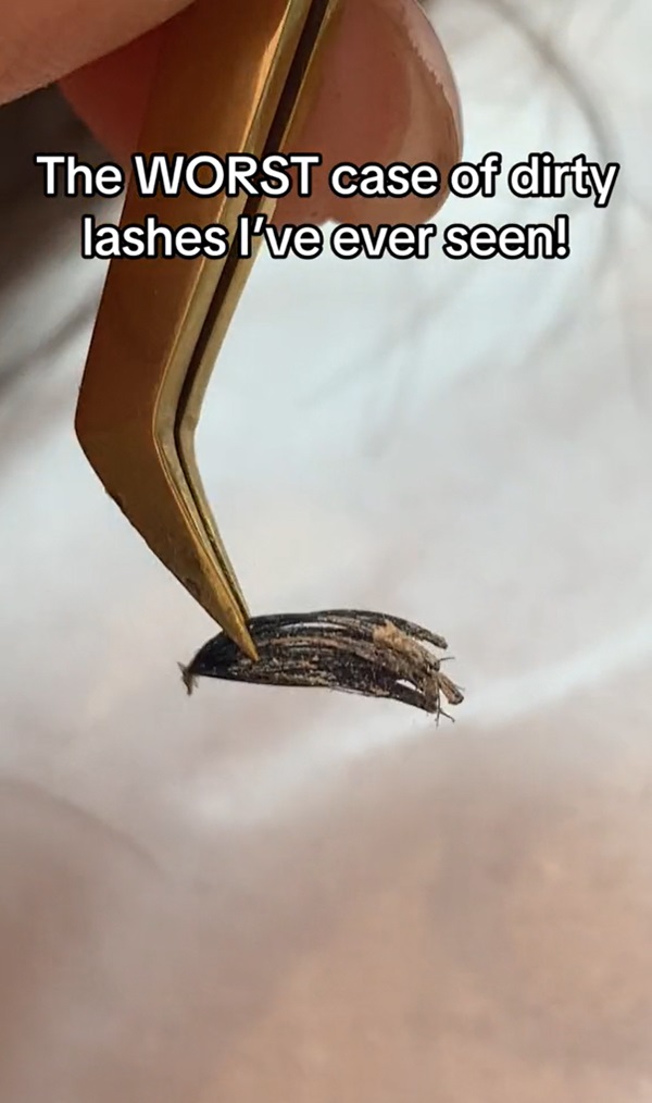 ขนตาสกปรก