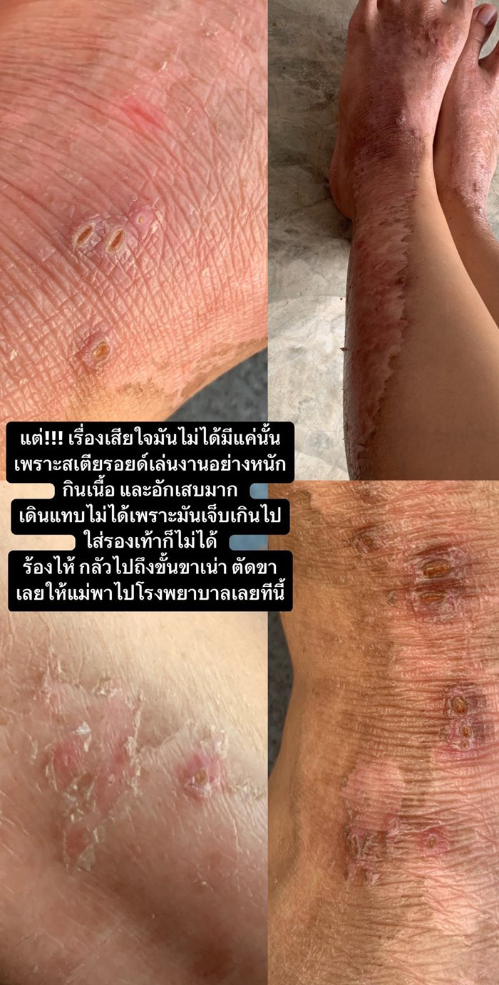 แมลงก้นกระดก