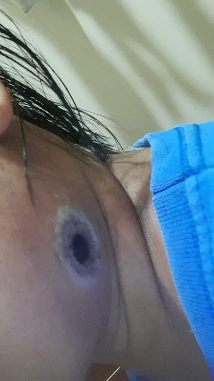 สัตว์มีพิษ