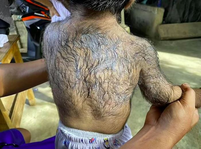 เด็กเกิดมาเป็นมนุษย์หมาป่า