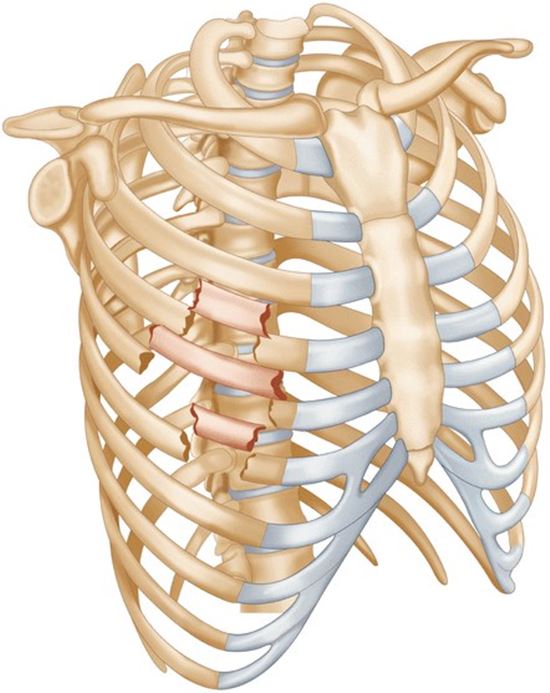 คดีป้าบัวผัน