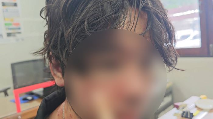 นักร้องถูกทำร้าย