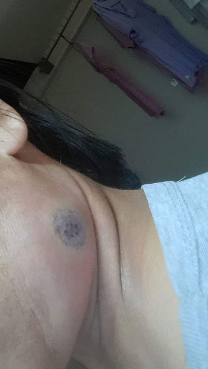 สัตว์มีพิษ