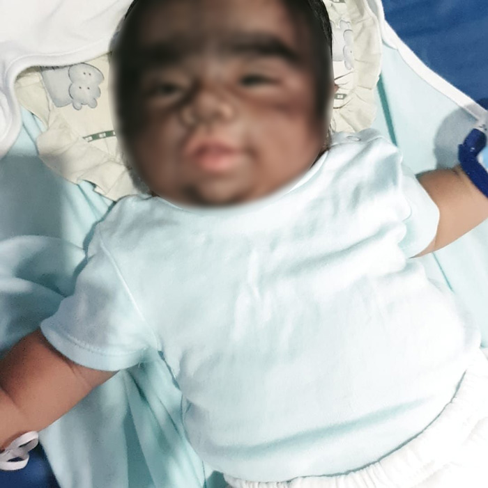 เด็กเกิดมาเป็นมนุษย์หมาป่า