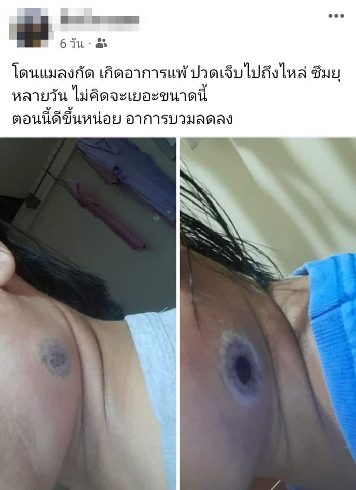 สัตว์มีพิษ