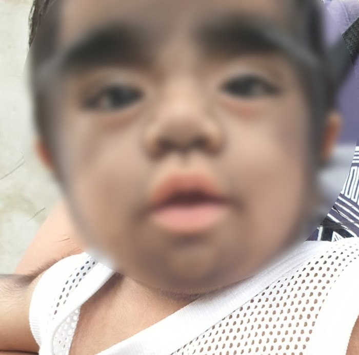 เด็กเกิดมาเป็นมนุษย์หมาป่า