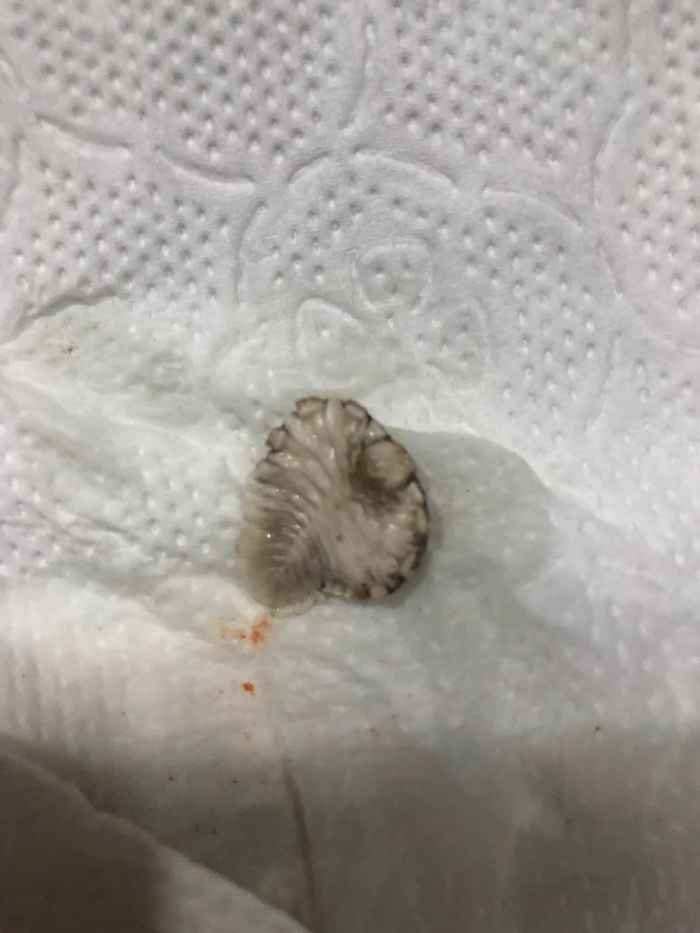 ปรสิต หัวกุ้ง