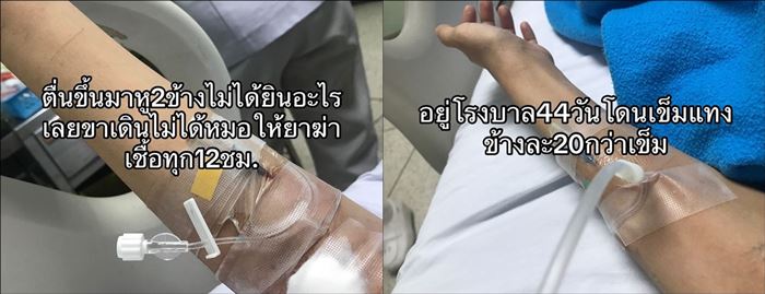 ป่วยหูดับ