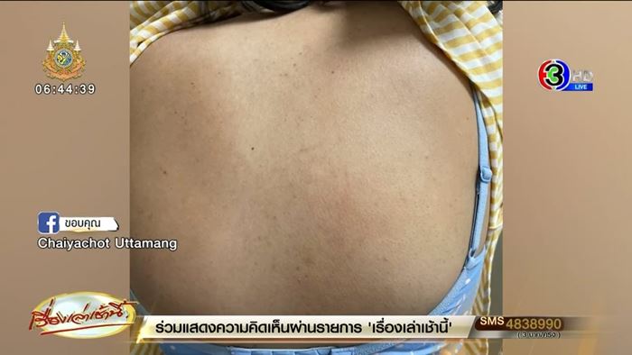 ฝรั่งถีบหมอ