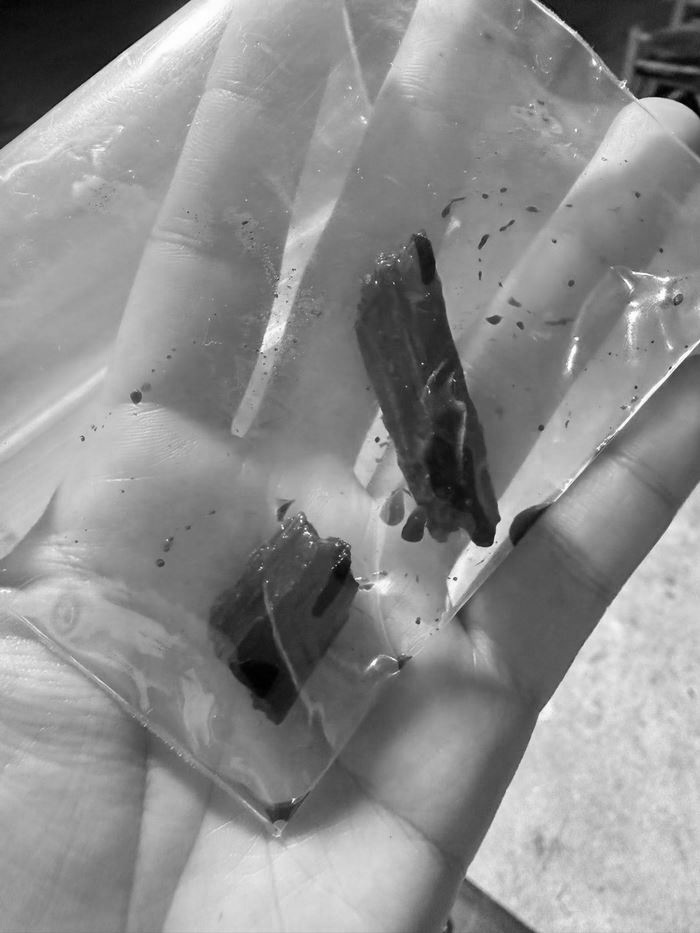 ตกต้นไม้ ผ่านไป 3 เดือนยังไม่หาย เปลี่ยน รพ. แล้วรู้เรื่องทันที