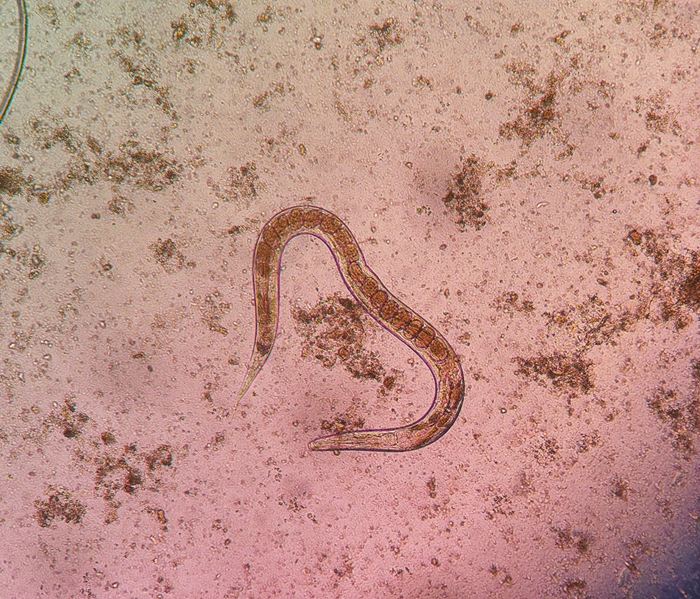 ผักสดมีพยาธิปนเปื้องสูง