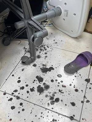 หนุ่มหัวร้อนสติหลุด ต่อยหมอสาวเลือดสาดคลินิก