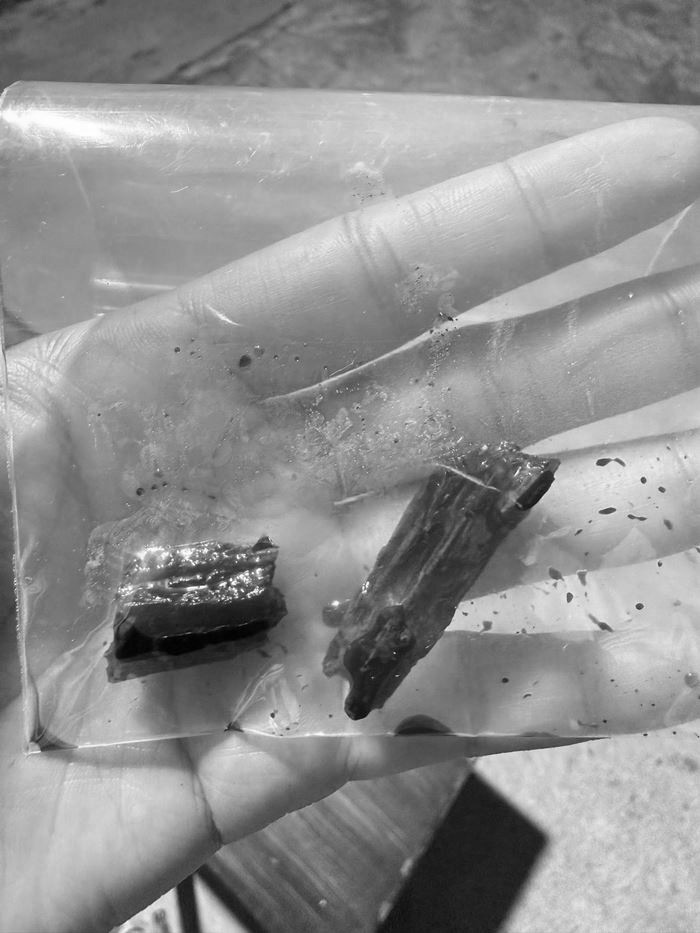 ตกต้นไม้ ผ่านไป 3 เดือนยังไม่หาย เปลี่ยน รพ. แล้วรู้เรื่องทันที