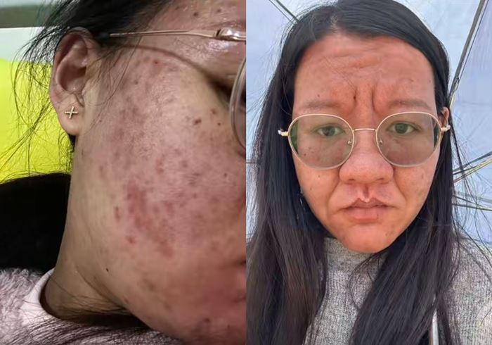 สาวเทียบสภาพ ก่อน-หลังท้อง หน้าเปลี่ยนจนจำตัวเองไม่ได้ สาวเทียบสภาพ ก่อน-หลังท้อง หน้าเปลี่ยนจนจำตัวเองไม่ได้